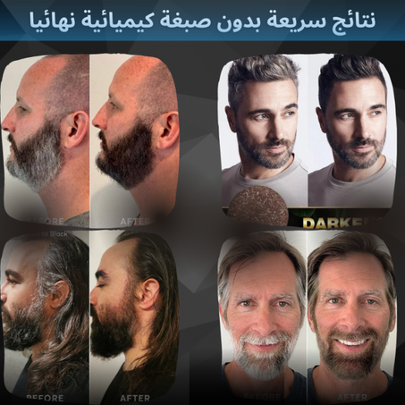 صابونة للقضاء على الشيب