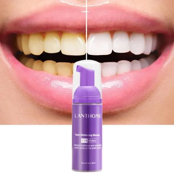 Gel de dent lanthome