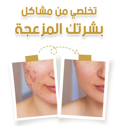 جل منظف لطيف بهلام الحلزون، يومي ذو تأثيرات تجديدية ومرطبة قوية