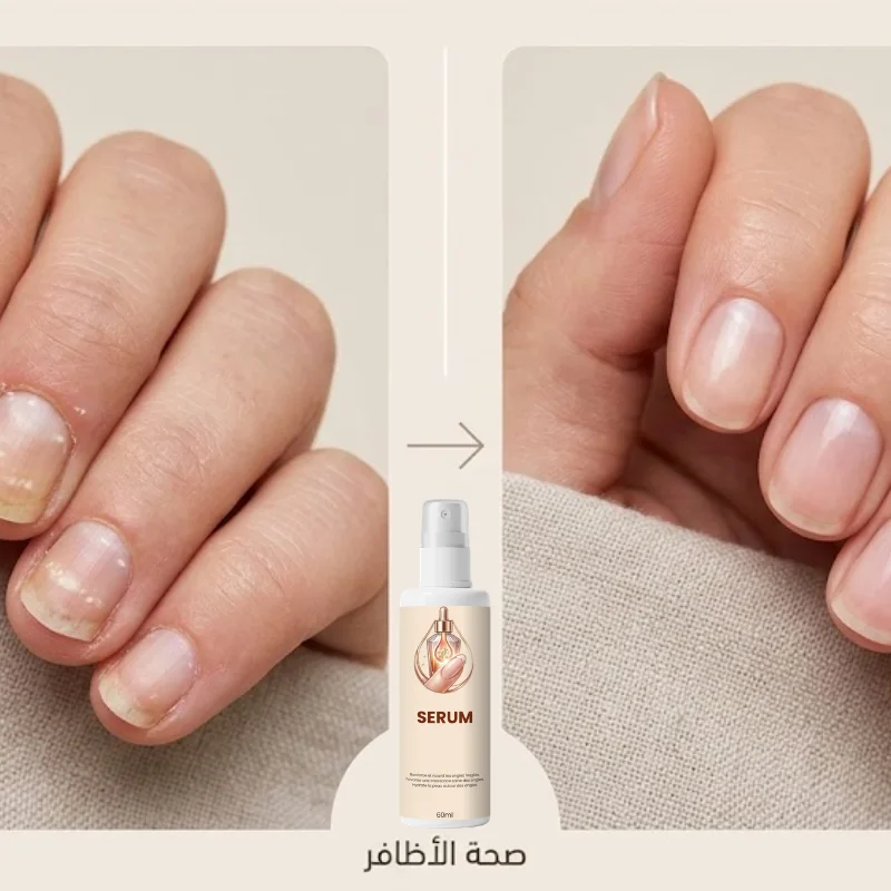 سيروم العناية وتقوية الأظافر ✨