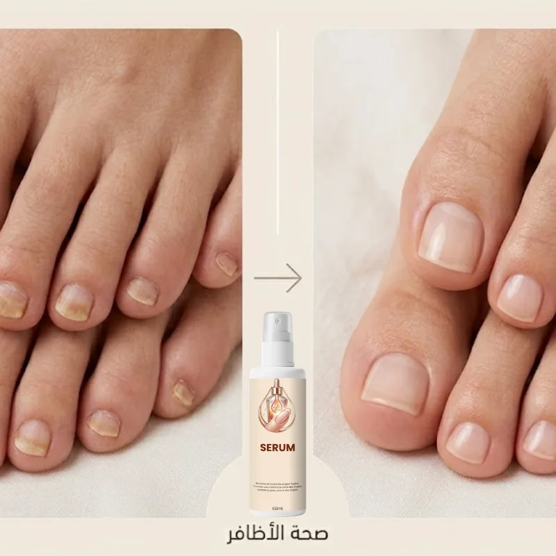 سيروم العناية وتقوية الأظافر ✨