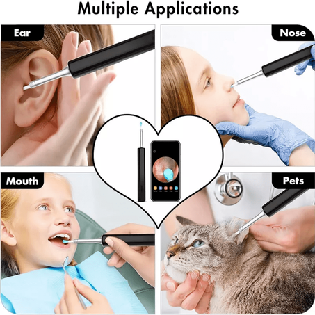 جهاز اندوسكوب لتنظيف وفحص الأذن SMART ENDOSCOPE