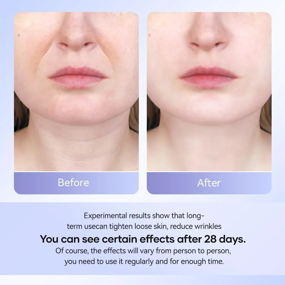 جهاز شد الوجه والرقبة وتقليل التجاعيد بالأضواء الملونة والاهتزاز