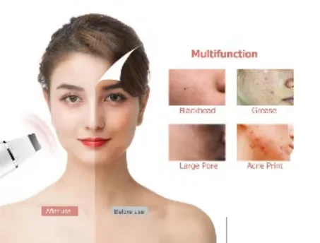 مقشر وتنظيف البشرة