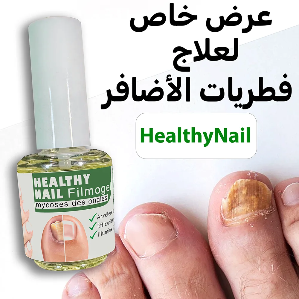 مضاد فطريات الأضافر