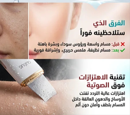 مكشطة الرؤوس السوداء