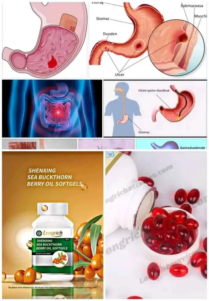 BERRY OIL DE LONGRICH