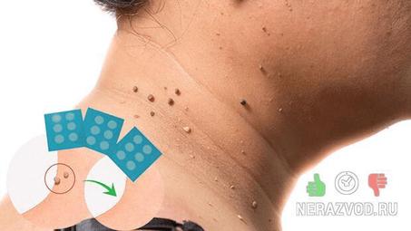 دواء التولال formuclear