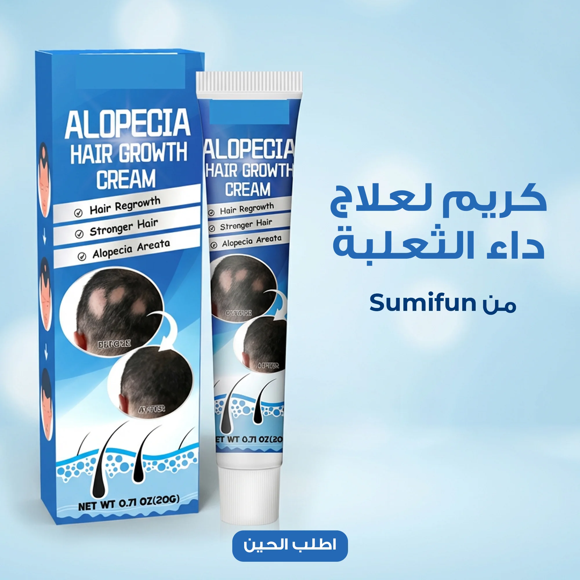 دهان طبيعي لعلاج داء الثعلبة - 20 جرام