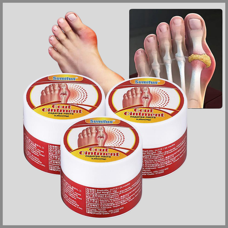 مرهم Sumifun لعلاج النقرس