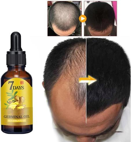 7 أيام تفصلك عن شعرٍ أقوى وأكثر كثافة