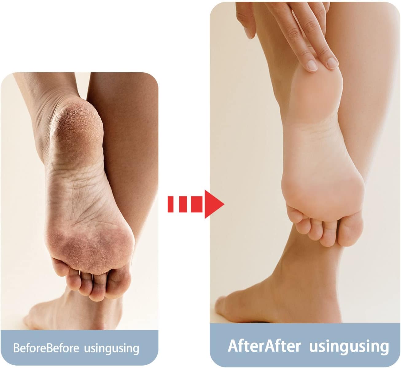 Moisturizing Socks - جوارب مرطبة