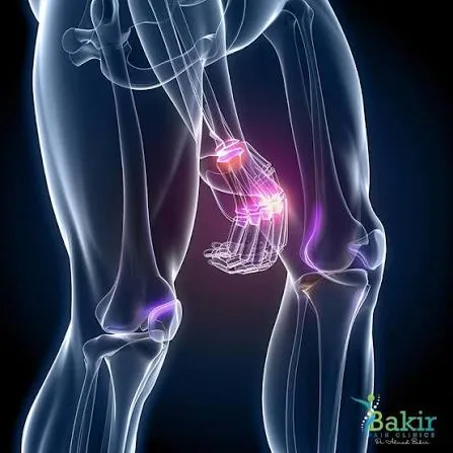 تركيبة متطورة تساعد على دعم صحة المفاصل والمساهمة في تخفيف الانزعاج