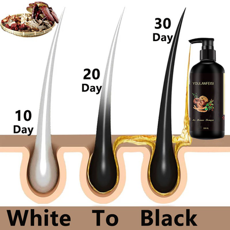 شامبو للشعر الاسود