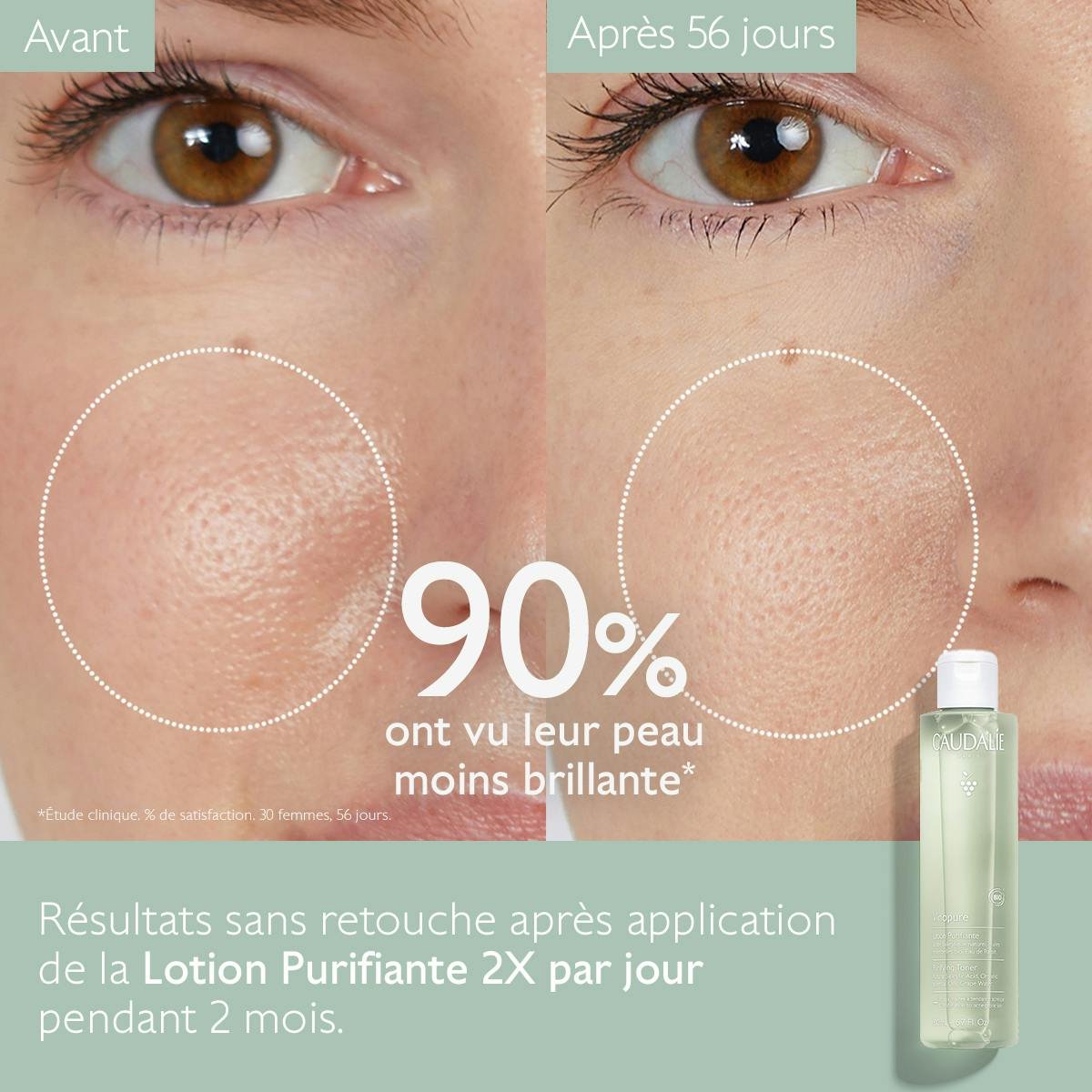 Vinopure Lotion Purifiante à l'Acide Salicylique - 200mL