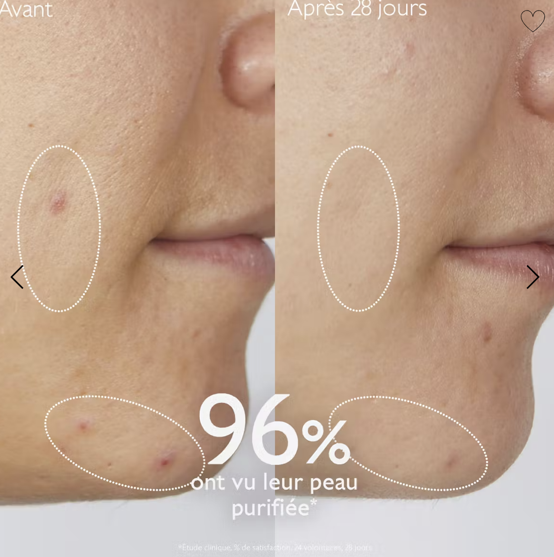 Vinopure Gelée Nettoyante à l'Acide Salicylique Purifiante - 150mL