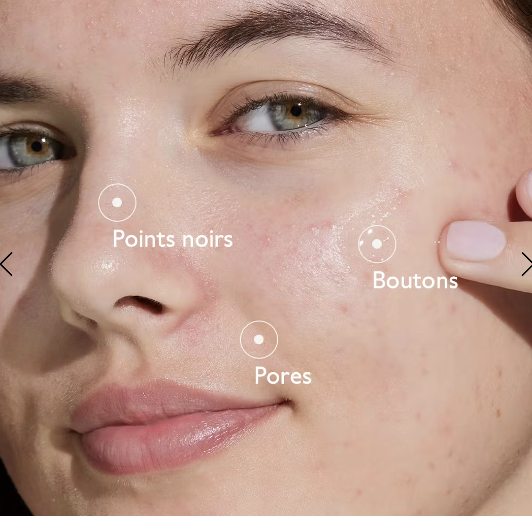 Vinopure Sérum à l'Acide Salicylique Anti-imperfections