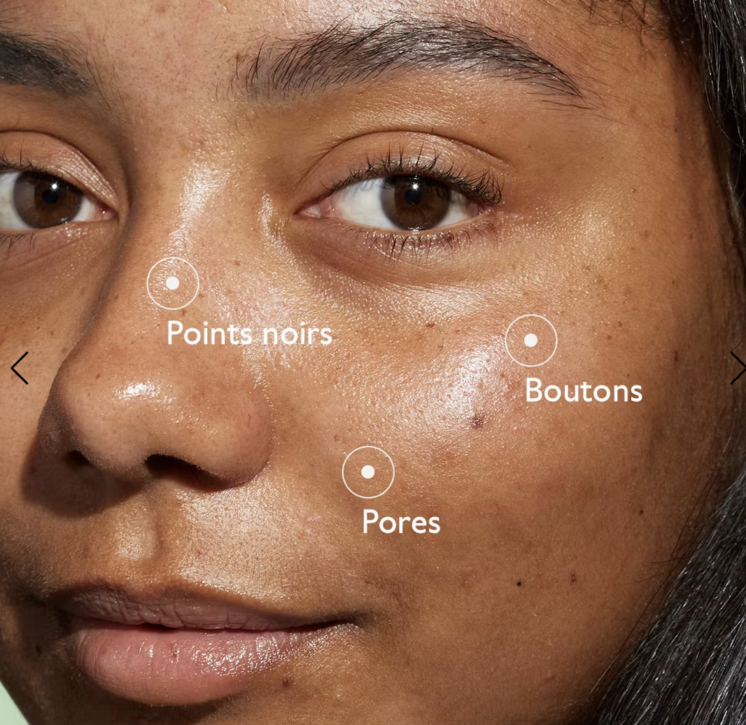 Vinopure Sérum à l'Acide Salicylique Anti-imperfections