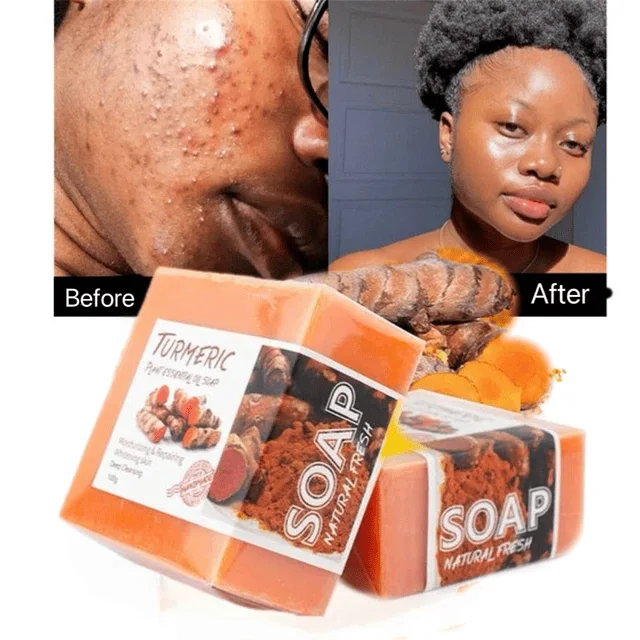 𝐓𝐔𝐑𝐌𝐄𝐑𝐈𝐂 𝐅𝐀𝐂𝐄 𝐒𝐎𝐀𝐏 ᵀᴹ : 𝐒𝐚𝐯𝐨𝐧 𝐭𝐡é𝐫𝐚𝐩𝐞𝐮𝐭𝐢𝐪𝐮𝐞 𝐚𝐮 𝐂𝐮𝐫𝐜𝐮𝐦𝐚 (𝐝𝐢𝐭𝐞𝐬 𝐚𝐝𝐢𝐞𝐮 à 𝐥𝐚 𝐩𝐞𝐚𝐮 𝐭𝐞𝐫𝐧𝐞, 𝐚𝐮𝐱 𝐭𝐚𝐜𝐡𝐞𝐬 𝐞𝐭 𝐚𝐮 𝐯𝐢𝐞𝐢𝐥𝐥𝐢𝐬𝐬𝐞𝐦𝐞𝐧𝐭)