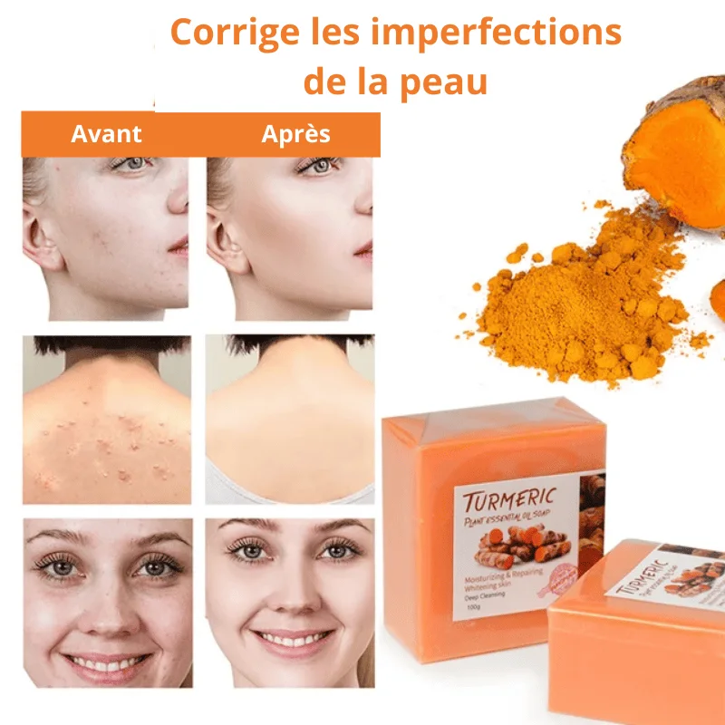 𝐓𝐔𝐑𝐌𝐄𝐑𝐈𝐂 𝐅𝐀𝐂𝐄 𝐒𝐎𝐀𝐏 ᵀᴹ : 𝐒𝐚𝐯𝐨𝐧 𝐭𝐡é𝐫𝐚𝐩𝐞𝐮𝐭𝐢𝐪𝐮𝐞 𝐚𝐮 𝐂𝐮𝐫𝐜𝐮𝐦𝐚 (𝐝𝐢𝐭𝐞𝐬 𝐚𝐝𝐢𝐞𝐮 à 𝐥𝐚 𝐩𝐞𝐚𝐮 𝐭𝐞𝐫𝐧𝐞, 𝐚𝐮𝐱 𝐭𝐚𝐜𝐡𝐞𝐬 𝐞𝐭 𝐚𝐮 𝐯𝐢𝐞𝐢𝐥𝐥𝐢𝐬𝐬𝐞𝐦𝐞𝐧𝐭)