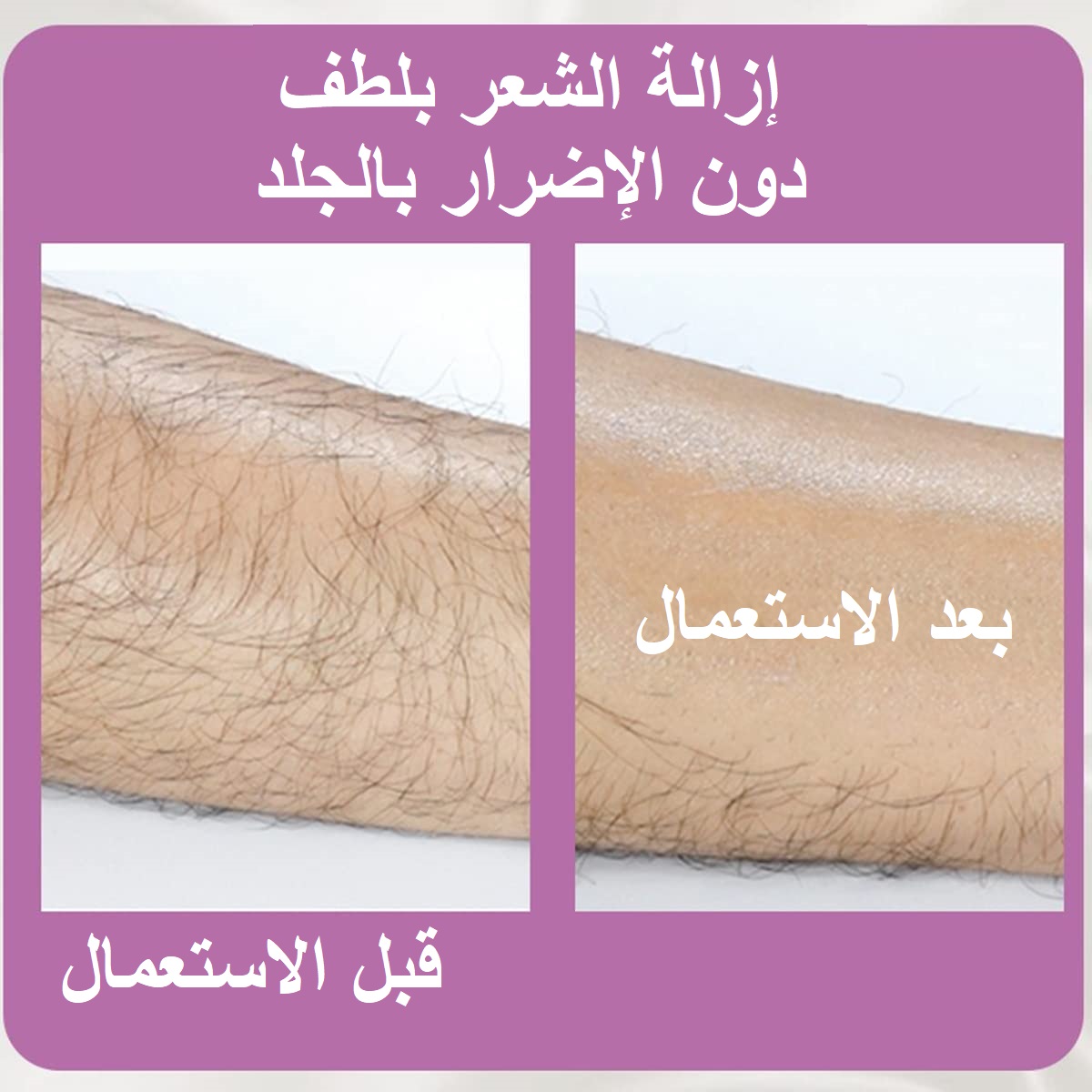 stores/2641b775d34a9010428a268052b65923/products/VS5PcxNZpm9RuAM2rw4s37PDllXZunQ4O9kESDaw.jpeg
