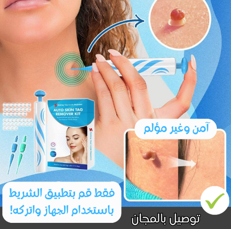 طقم إزالة الثآليل الجلدية