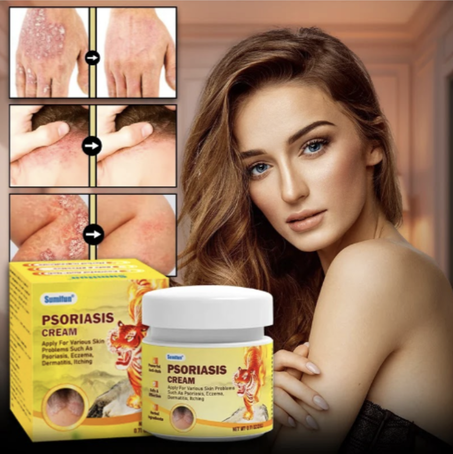 كريم علاج الصدفية والأكزيما