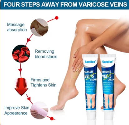 Crème Varicose Veins - Soulagement Rapide et Efficace des Varices