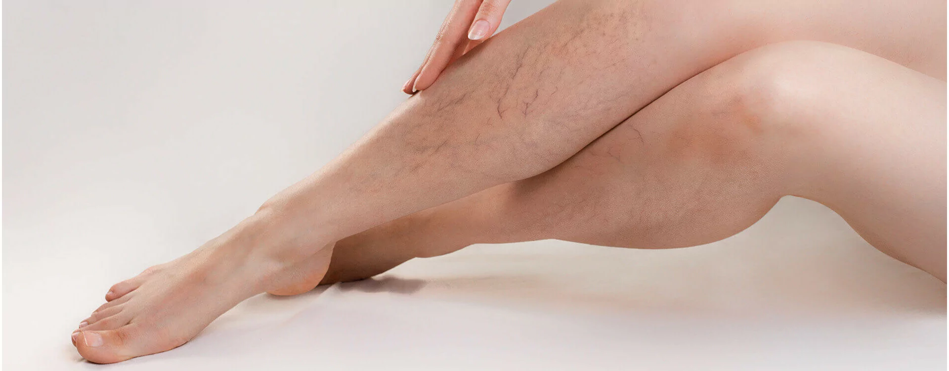 Crème Varicose Veins - Soulagement Rapide et Efficace des Varices