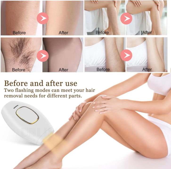 Epilateur laser