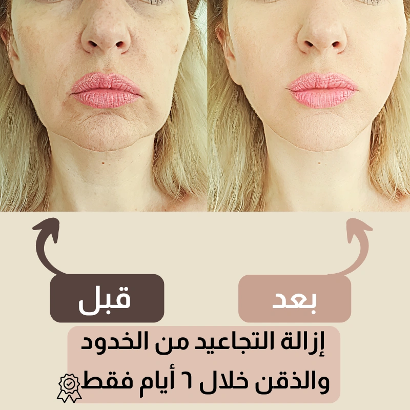 حزام شد الوجه الأمريكي للتخلص من التجاعيد 🔥