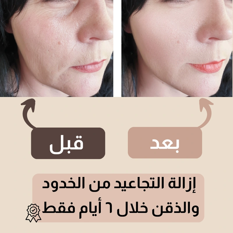 حزام شد الوجه الأمريكي للتخلص من التجاعيد 🔥