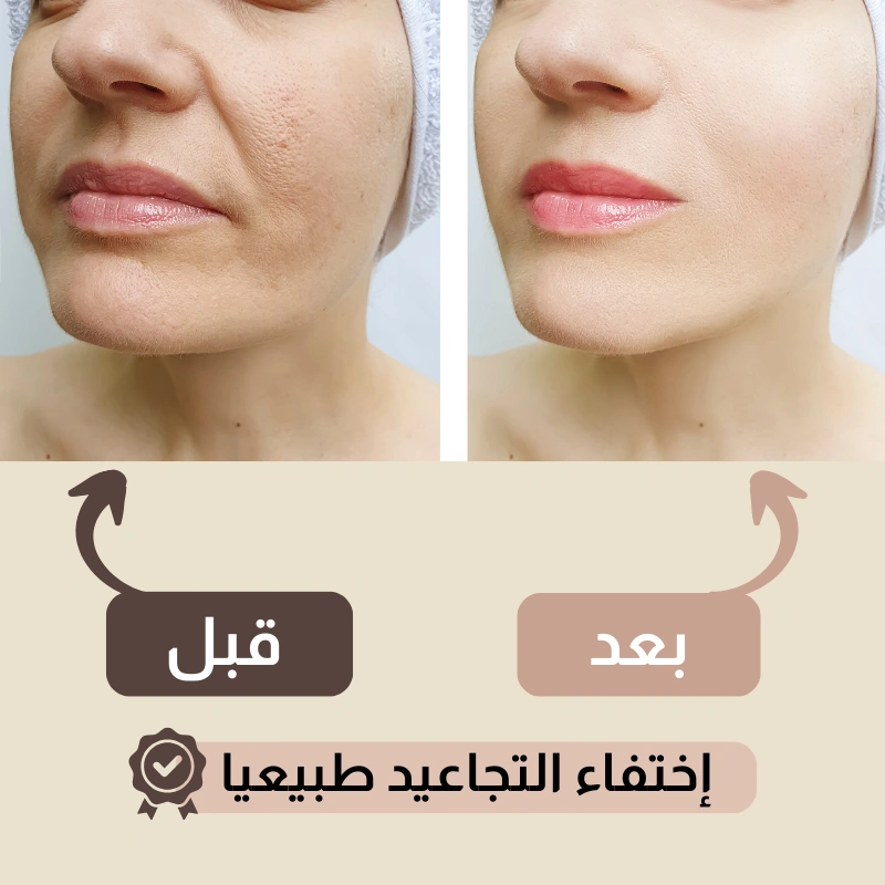 حزام شد الوجه الأمريكي للتخلص من التجاعيد 🔥