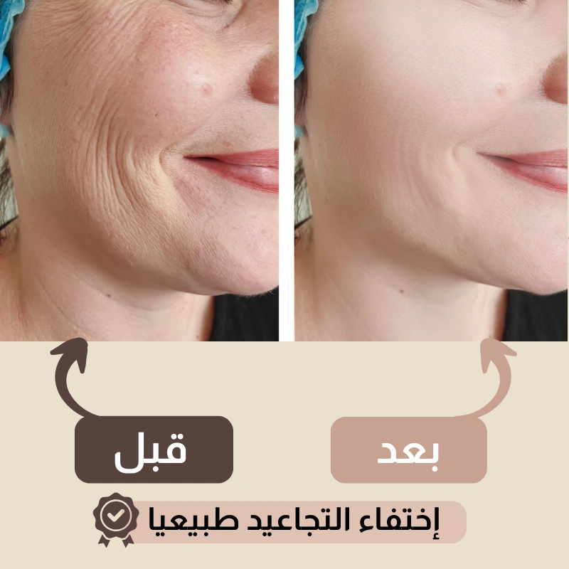 حزام شد الوجه الأمريكي للتخلص من التجاعيد 🔥