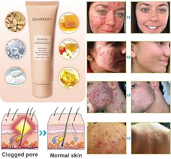 جل تقشير نباتي لترطيب وتهدئة البشرة وإصلاحها – 50 جم