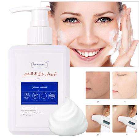 مزيل النمش لتبييض البشرة