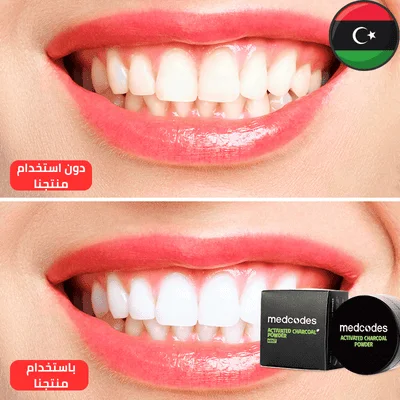 تبييض الأسنان الأكثر مبيعا