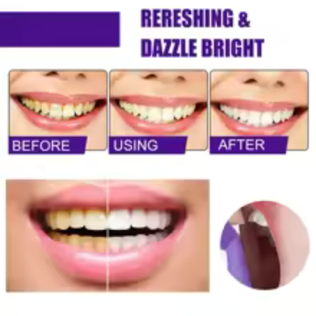 Foam Teeth Whitening - KSA