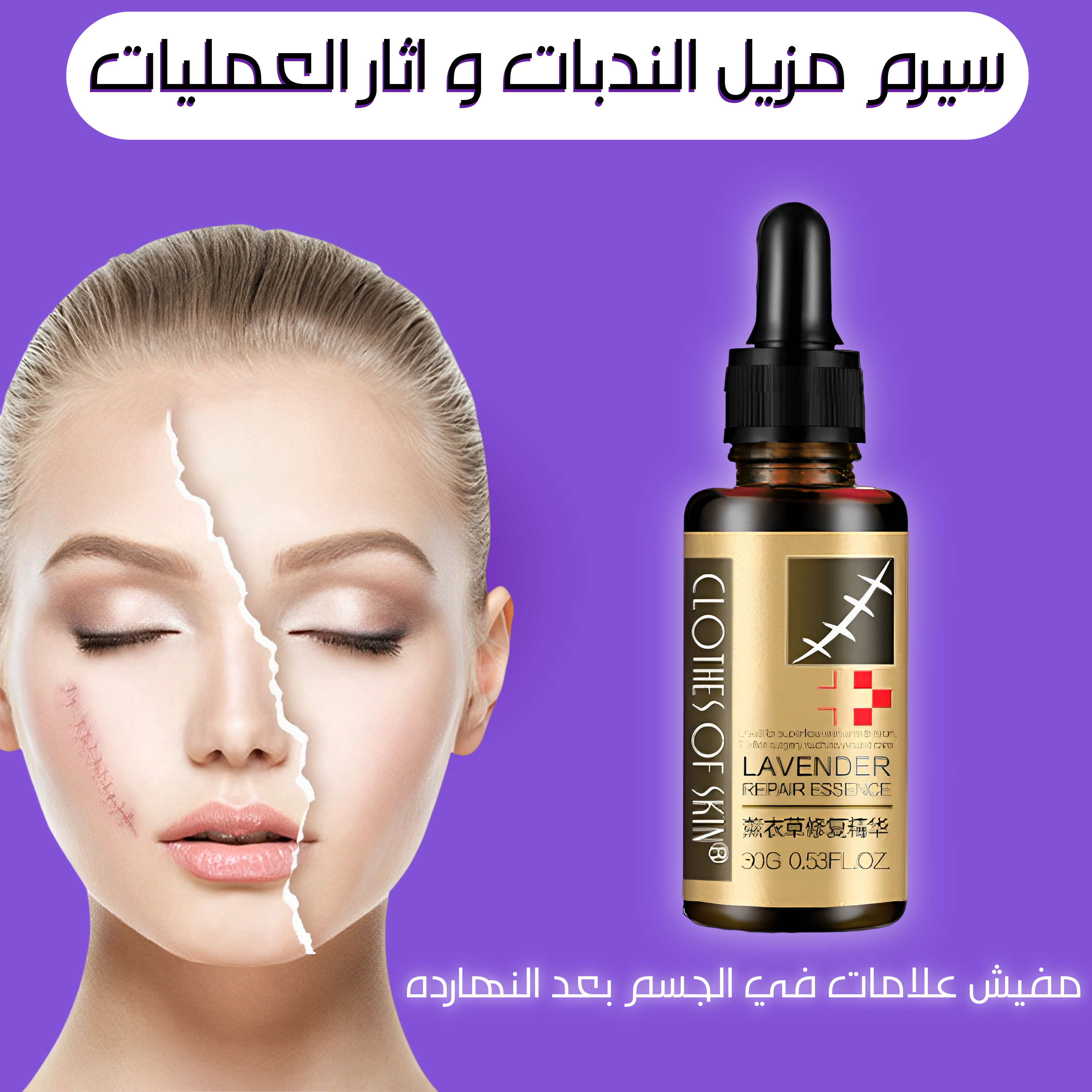 سيرم مزيل الندبات و اثار العمليات