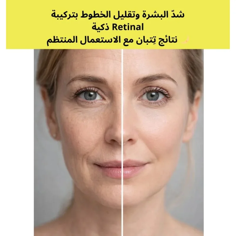 سيروم سليمكس ريتينال شوت لشد البشرة ومحاربة التجاعيد