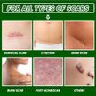 stores/29e786691aeb72900dd75db646d0b7e4/products/AOpV2vfWDGVp7pCUD56BUVNGSfy3SMn8x2Skv7g1.jpg