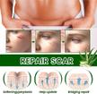stores/29e786691aeb72900dd75db646d0b7e4/products/dCYaFwDi3P3kdoXonoiwnK2Lm5UGD7TreDxATcdt.jpg