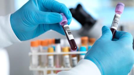 Analyses médicales courantes