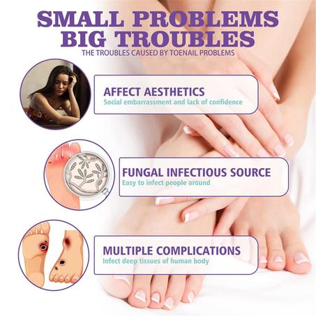 سبراي لعلاج الفطريات