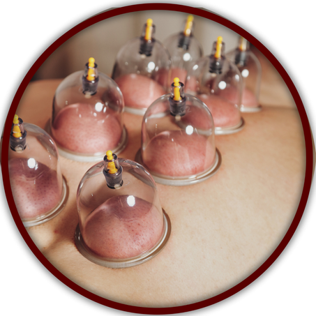 جهاز الحجامة الكهربائي