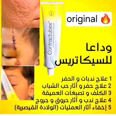 🌿 جل كونتراكتوبيكس Contractubex لعلاج الندبات وآثار الجروح