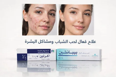 ودّع حبّ الشباب