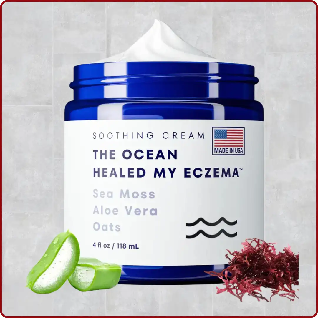 كريم الأكزيما أو الصدفية