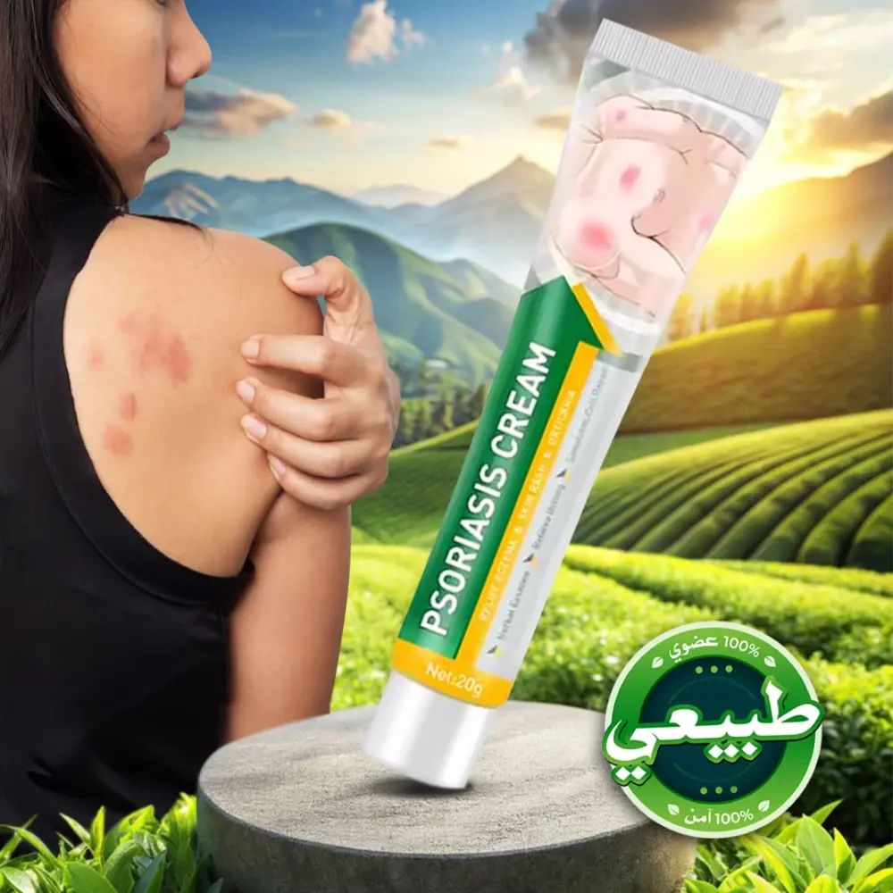 كريم لعلاج الصدفية والأكزيما بالأعشاب الطبيعية