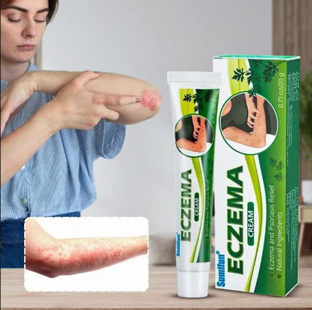 كريم لعلاج الأكزيما والصدفية (20 غرام)